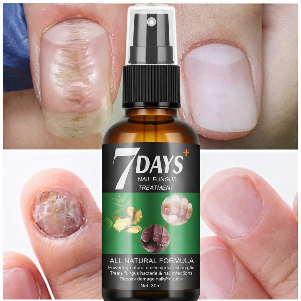 5x1 Serum 7 Días: Las Uñas Fuertes y Largas Que Siempre Quisiste Tener
