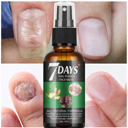 5x1 Serum 7 Días: Las Uñas Fuertes y Largas Que Siempre Quisiste Tener